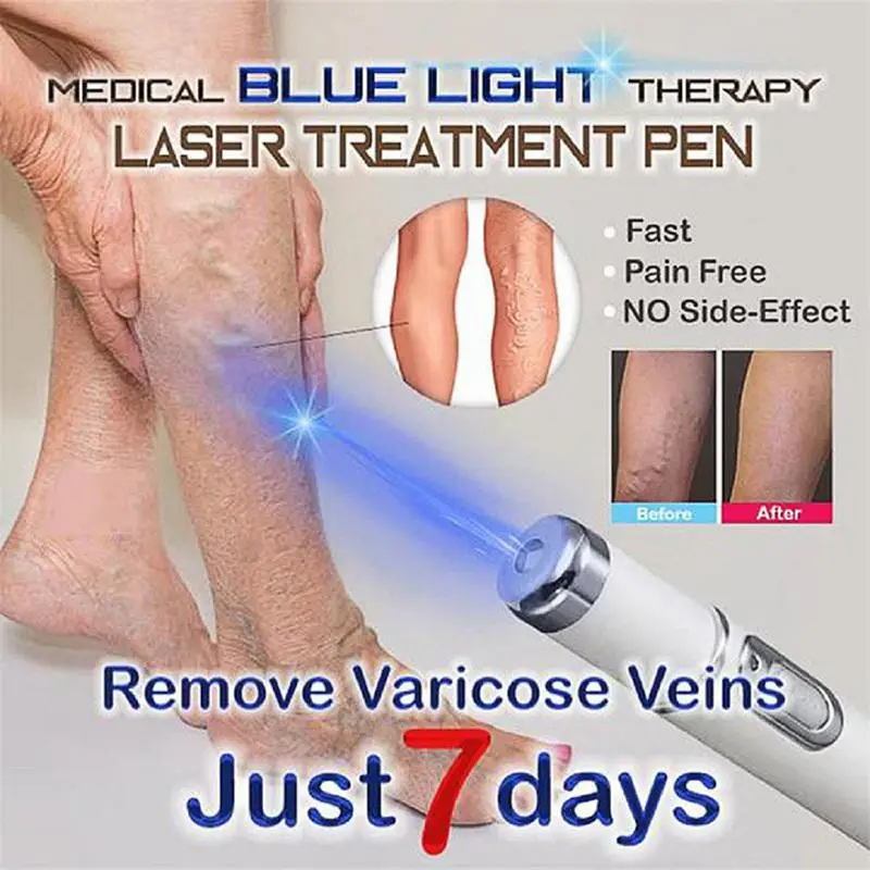 Hot Heath Blå Lys Terapi Åreknuder Behandling Laser Pen Bløde Ar, Rynke Fjernelse Behandling Af Acne Laser Pen Massage Slappe Af
