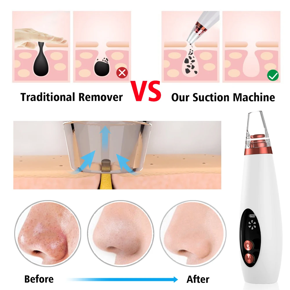 2020 USB-Hudorm Hud Skrubber Sort Prik Remover Face Pore Vakuum hudpleje Acne Pore Renere Bums Fjernelse Vakuum
