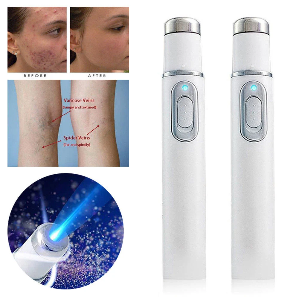 Blåt Lys Acne Laser Terapi Pen Bløde Ar, Rynke Fjernelse Behandling Enheden Hudpleje Skønheds-Udstyr