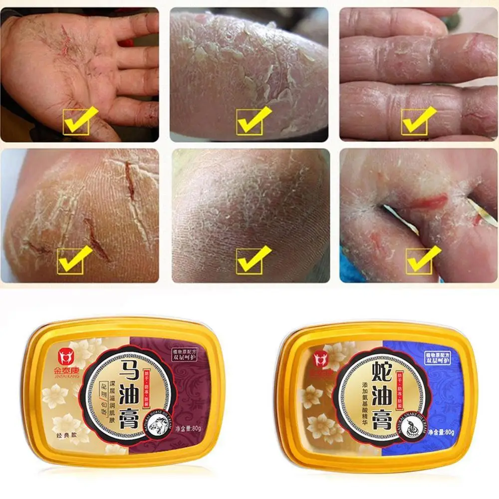Universal 88g Slange Olie Bud Hand Cream Hand Care Antibakterielle, Anti-chapping Kridtning Plejende hudpleje Creme
