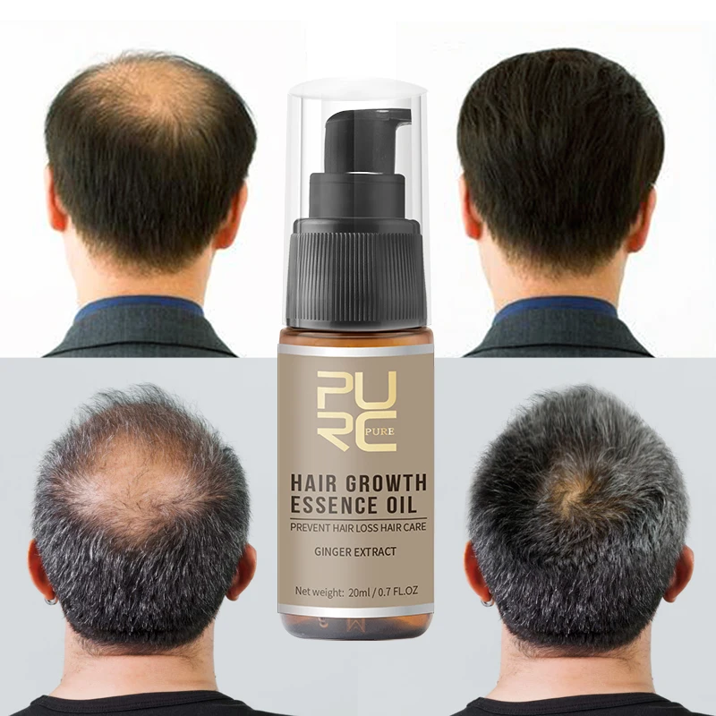 Nye PURC Hot salg Vækst Hår Væsentlige Olie Forhindre hårtab Spray Hjælp til hår Vækst hår Pleje
